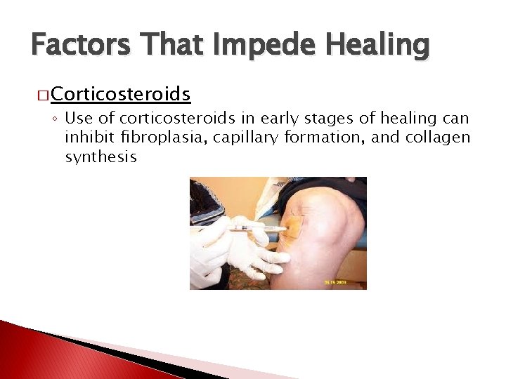 Factors That Impede Healing � Corticosteroids ◦ Use of corticosteroids in early stages of
