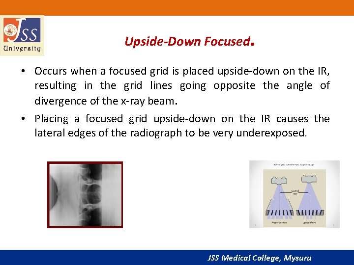 Upside-Down Focused. • Occurs when a focused grid is placed upside-down on the IR,