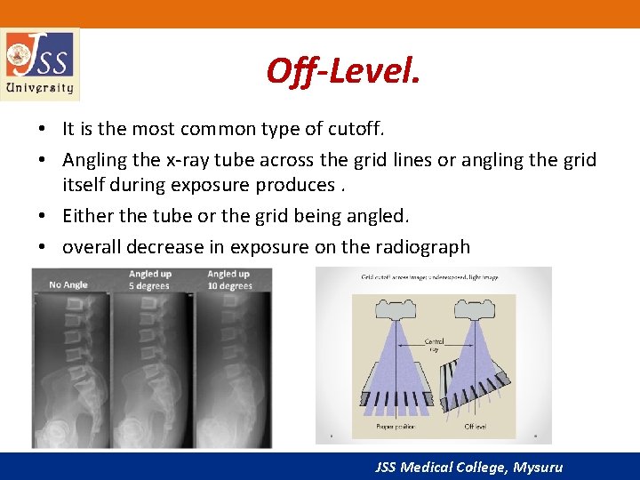 Off-Level. • It is the most common type of cutoff. • Angling the x-ray