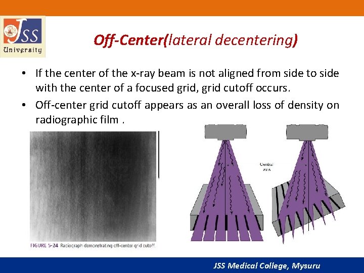 Off-Center(lateral decentering) • If the center of the x-ray beam is not aligned from