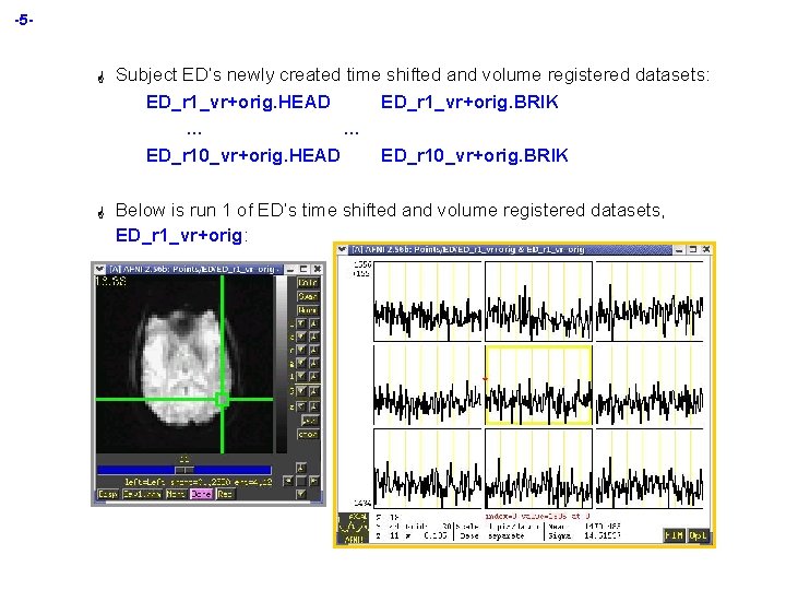 -5 - G Subject ED’s newly created time shifted and volume registered datasets: ED_r