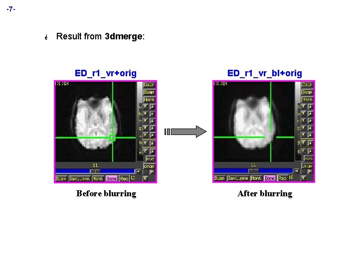 -7 - G Result from 3 dmerge: ED_r 1_vr+orig ED_r 1_vr_bl+orig Before blurring After