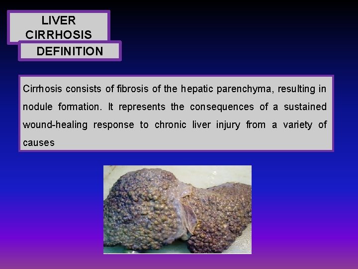 LIVER CIRRHOSIS DEFINITION Cirrhosis consists of fibrosis of the hepatic parenchyma, resulting in nodule