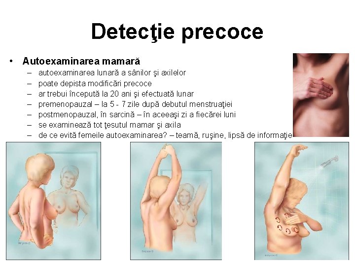 Detecţie precoce • Autoexaminarea mamară – – – – autoexaminarea lunară a sânilor şi