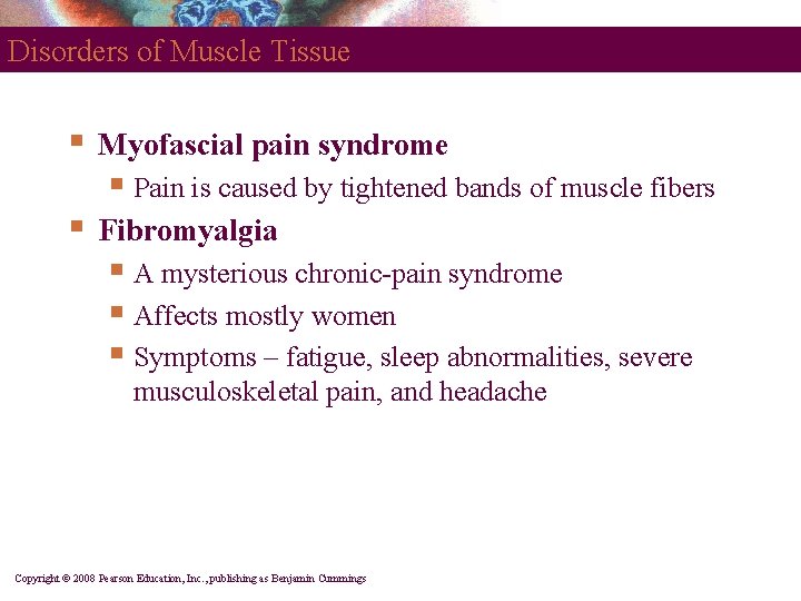 Disorders of Muscle Tissue § Myofascial pain syndrome § Pain is caused by tightened