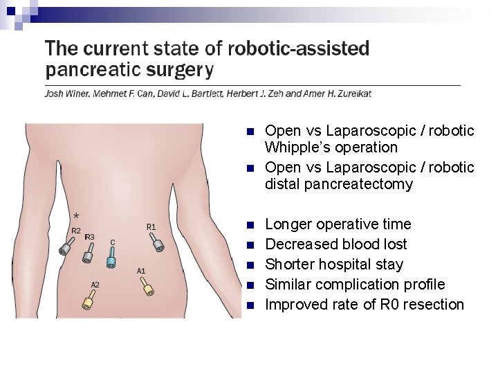 n n n n Open vs Laparoscopic / robotic Whipple’s operation Open vs Laparoscopic