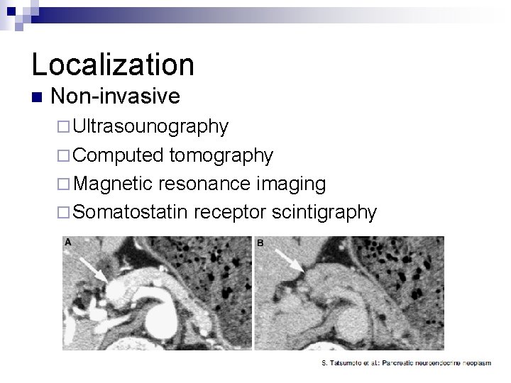 Localization n Non-invasive ¨ Ultrasounography ¨ Computed tomography ¨ Magnetic resonance imaging ¨ Somatostatin