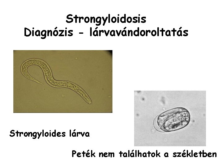 Strongyloidosis diagnózis A strongyloidosis tünetek, Strongyloida fertőzés (strongyloidosis)