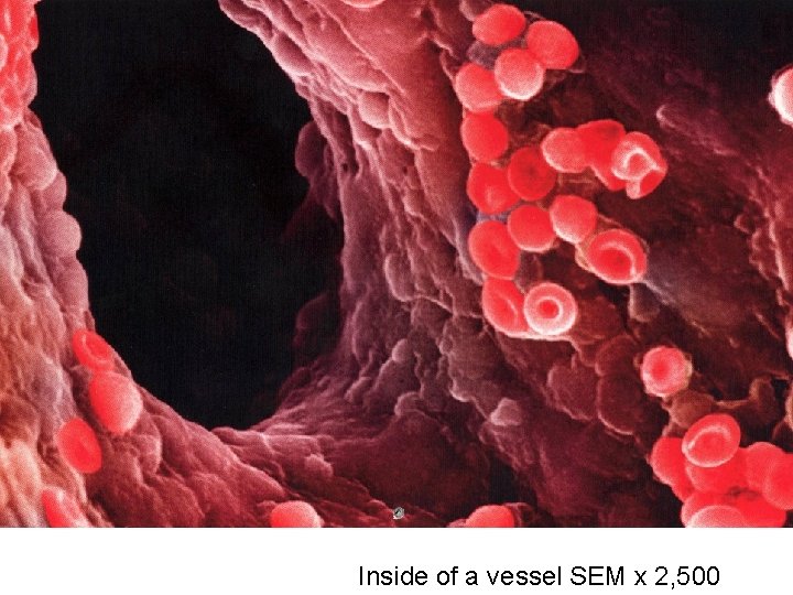 Inside of a vessel SEM x 2, 500 