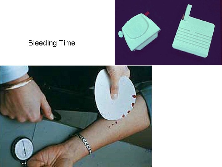 Bleeding Time 