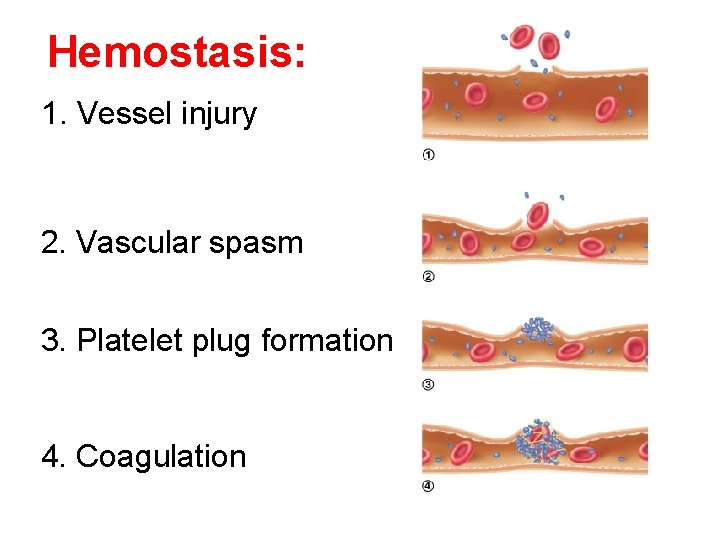 Hemostasis: 1. Vessel injury 2. Vascular spasm 3. Platelet plug formation 4. Coagulation 