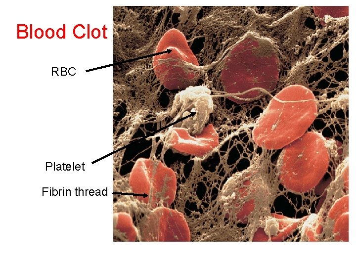 Blood Clot RBC Platelet Fibrin thread 