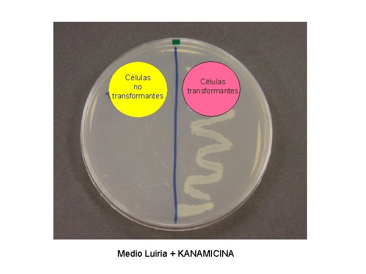 Células no transformantes Células transformantes Medio Luiria + KANAMICINA Células no transformantes Células transformantes Medio Luiria + KANAMICINA