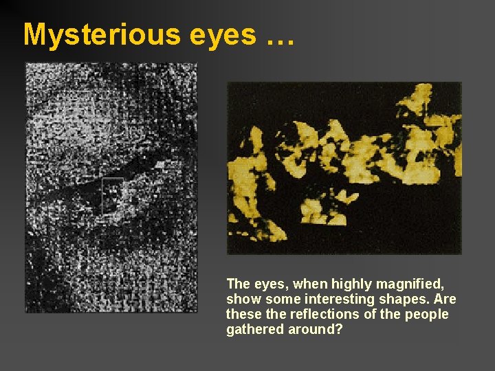 Mysterious eyes … The eyes, when highly magnified, show some interesting shapes. Are these