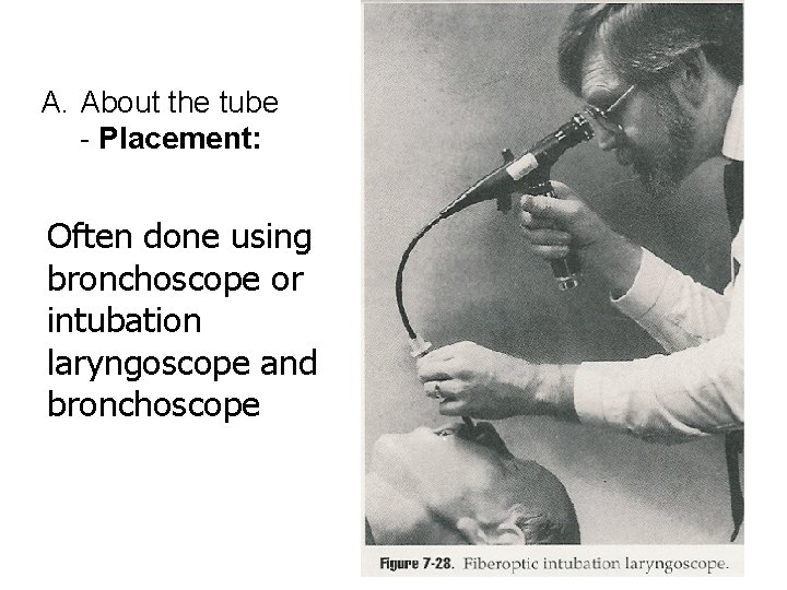 A. About the tube - Placement: Often done using bronchoscope or intubation laryngoscope and