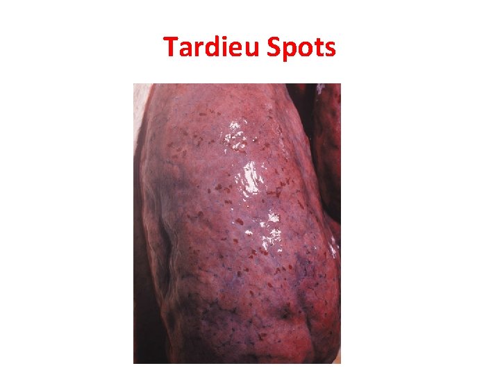 Tardieu Spots 