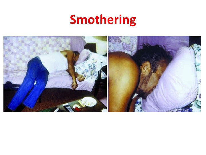 Smothering 