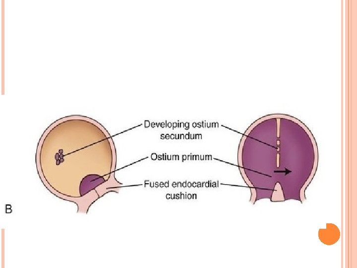 DEVELOPMENT OF INTERATRIAL AND INTERVENTRICULAR SEPTUM RANJITH SENIOR