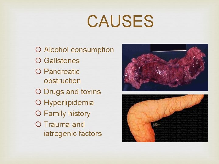 CAUSES ¡ Alcohol consumption ¡ Gallstones ¡ Pancreatic obstruction ¡ Drugs and toxins ¡
