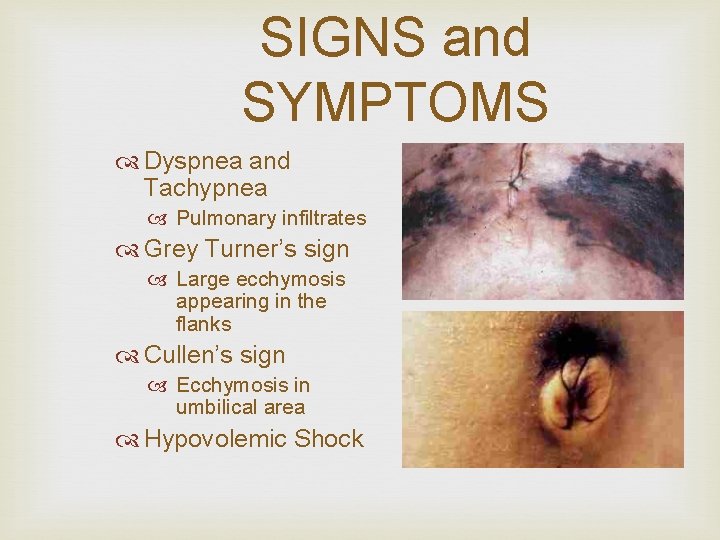 SIGNS and SYMPTOMS Dyspnea and Tachypnea Pulmonary infiltrates Grey Turner’s sign Large ecchymosis appearing