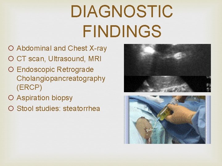 DIAGNOSTIC FINDINGS ¡ Abdominal and Chest X-ray ¡ CT scan, Ultrasound, MRI ¡ Endoscopic