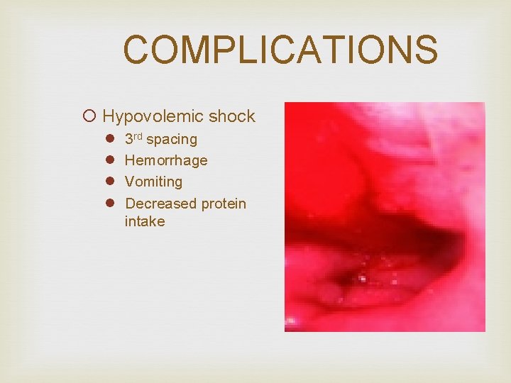 COMPLICATIONS ¡ Hypovolemic shock l l 3 rd spacing Hemorrhage Vomiting Decreased protein intake