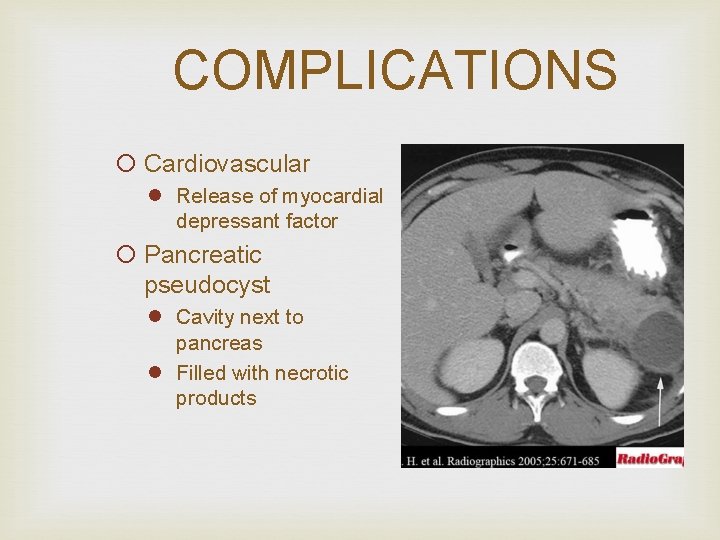 COMPLICATIONS ¡ Cardiovascular l Release of myocardial depressant factor ¡ Pancreatic pseudocyst l Cavity