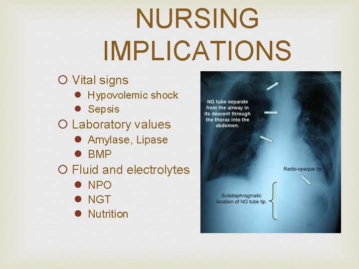 NURSING IMPLICATIONS ¡ Vital signs l Hypovolemic shock l Sepsis ¡ Laboratory values l