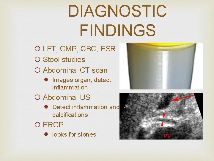 DIAGNOSTIC FINDINGS ¡ LFT, CMP, CBC, ESR ¡ Stool studies ¡ Abdominal CT scan