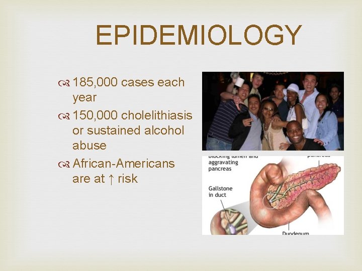 EPIDEMIOLOGY 185, 000 cases each year 150, 000 cholelithiasis or sustained alcohol abuse African-Americans