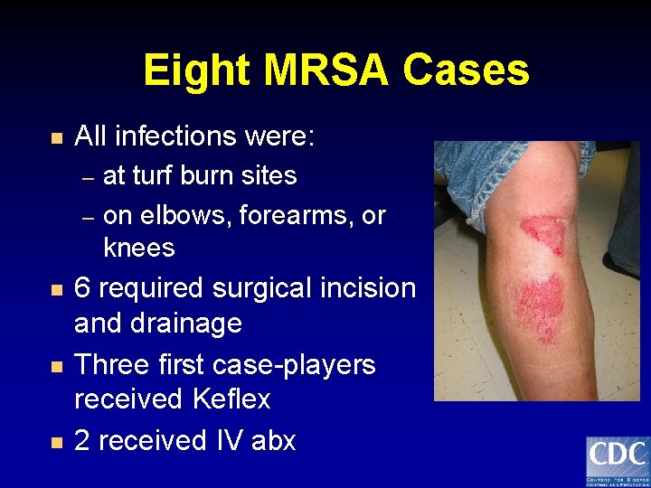 Eight MRSA Cases n All infections were: – – n n n at turf