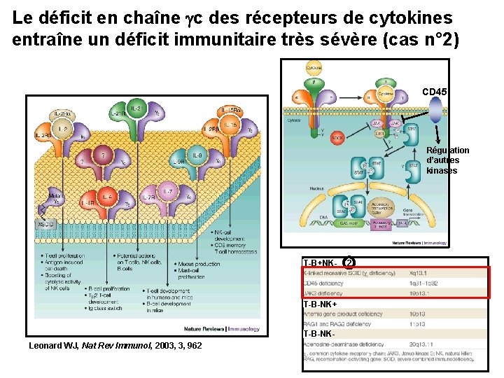 Le déficit en chaîne gc des récepteurs de cytokines entraîne un déficit immunitaire très
