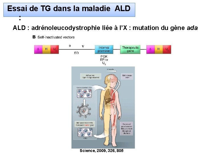 Essai de TG dans la maladie ALD : adrénoleucodystrophie liée à l’X : mutation