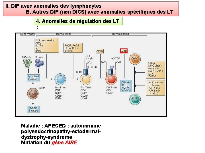 II. DIP avec anomalies des lymphocytes B. Autres DIP (non DICS) avec anomalies spécifiques