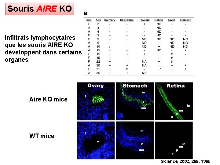 Souris AIRE KO Infiltrats lymphocytaires que les souris AIRE KO développent dans certains organes