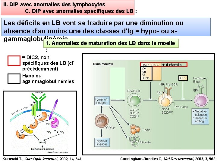 II. DIP avec anomalies des lymphocytes C. DIP avec anomalies spécifiques des LB :