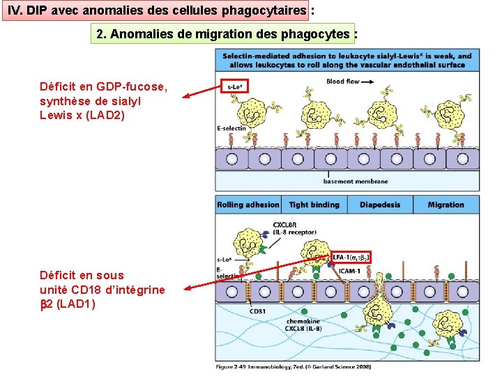 IV. DIP avec anomalies des cellules phagocytaires : 2. Anomalies de migration des phagocytes