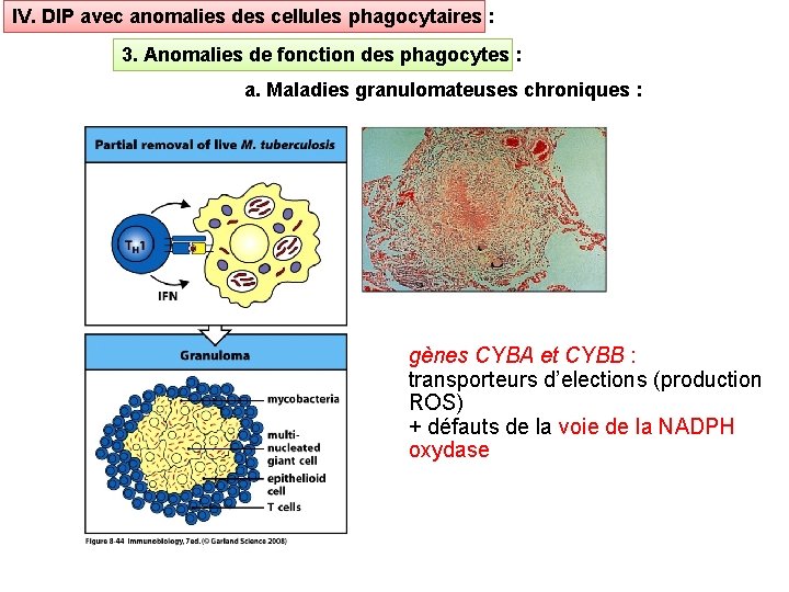 IV. DIP avec anomalies des cellules phagocytaires : 3. Anomalies de fonction des phagocytes