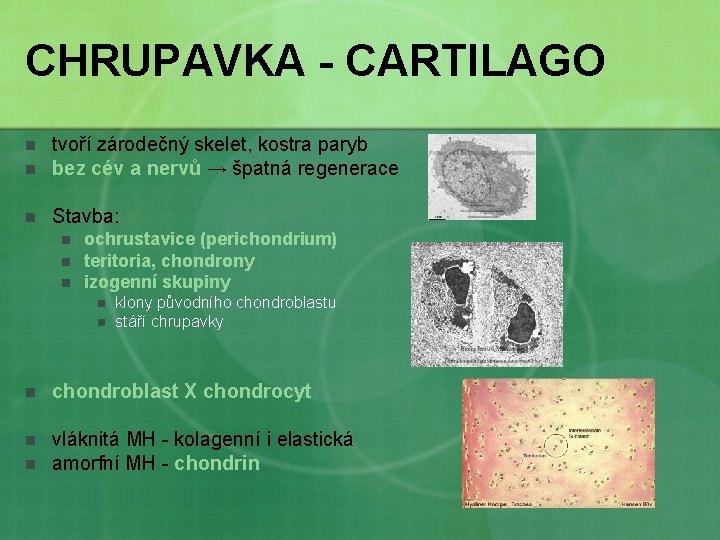 CHRUPAVKA - CARTILAGO n tvoří zárodečný skelet, kostra paryb bez cév a nervů →