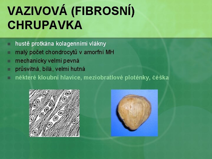 VAZIVOVÁ (FIBROSNÍ) CHRUPAVKA n n n hustě protkána kolagenními vlákny malý počet chondrocytů v