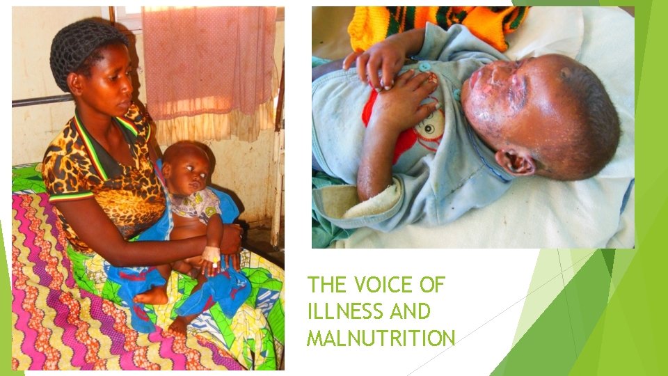 THE VOICE OF ILLNESS AND MALNUTRITION 
