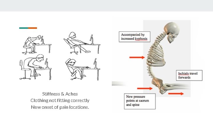 Stiffness & Aches Clothing not fitting correctly New onset of pain locations. 