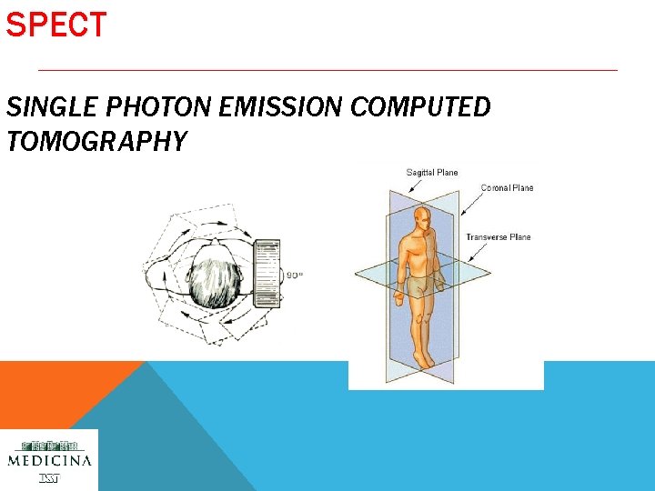 SPECT SINGLE PHOTON EMISSION COMPUTED TOMOGRAPHY 