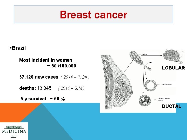 Breast cancer • Brazil Most incident in women ~ 50 /100, 000 LOBULAR 57.