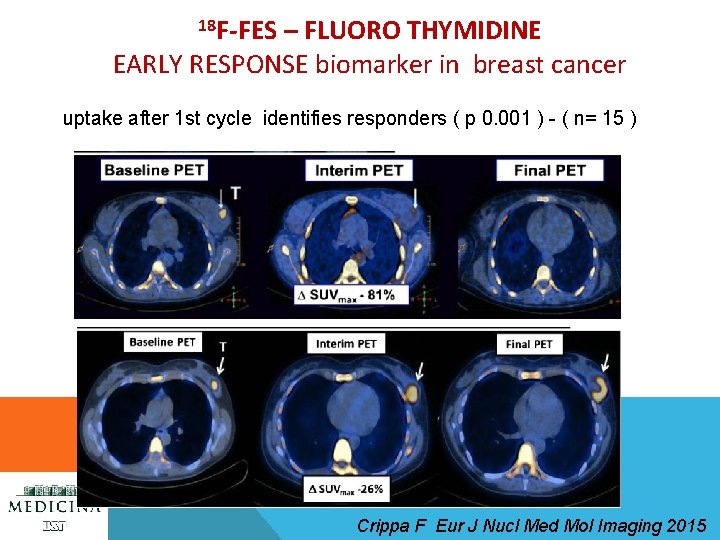 18 F-FES – FLUORO THYMIDINE EARLY RESPONSE biomarker in breast cancer uptake after 1