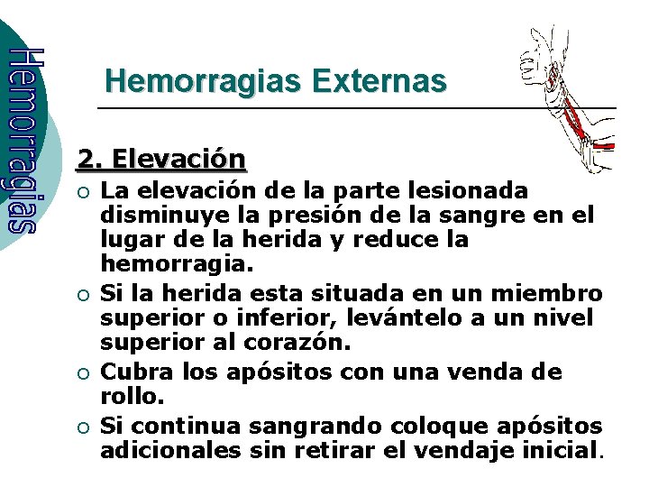 Hemorragias Externas 2. Elevación ¡ ¡ La elevación de la parte lesionada disminuye la