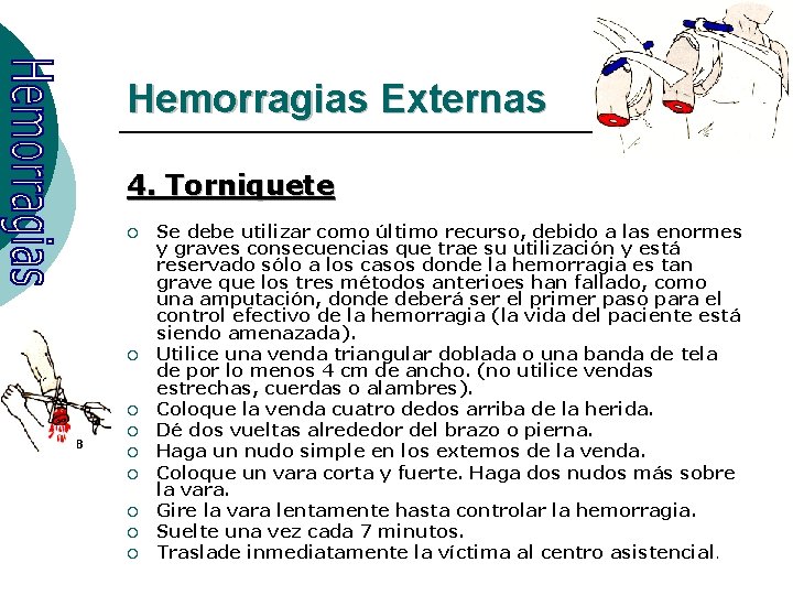 Hemorragias Externas 4. Torniquete ¡ ¡ ¡ ¡ ¡ Se debe utilizar como último