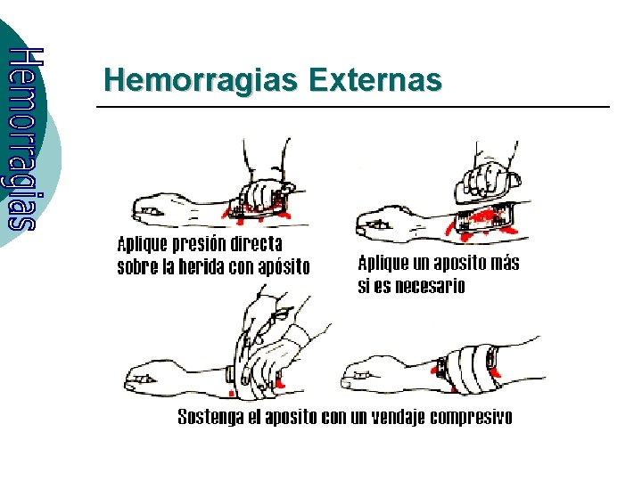 Hemorragias Externas 