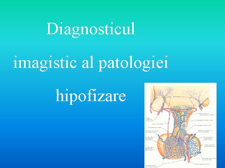 Diagnosticul imagistic al patologiei hipofizare 