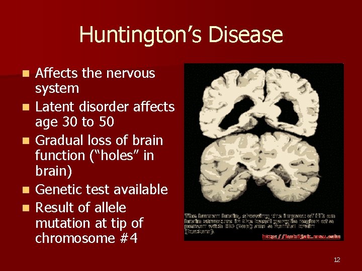 Huntington’s Disease n n n Affects the nervous system Latent disorder affects age 30